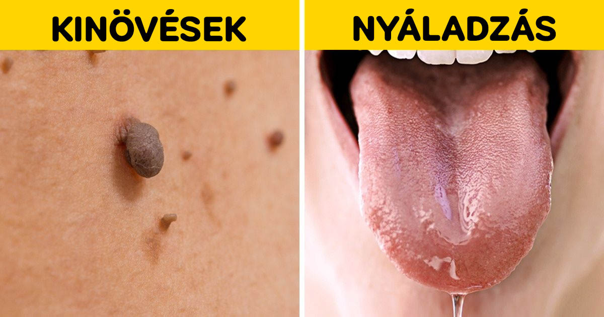 A terhesség 8 meglepő jele, amiről talán nem is tudtál