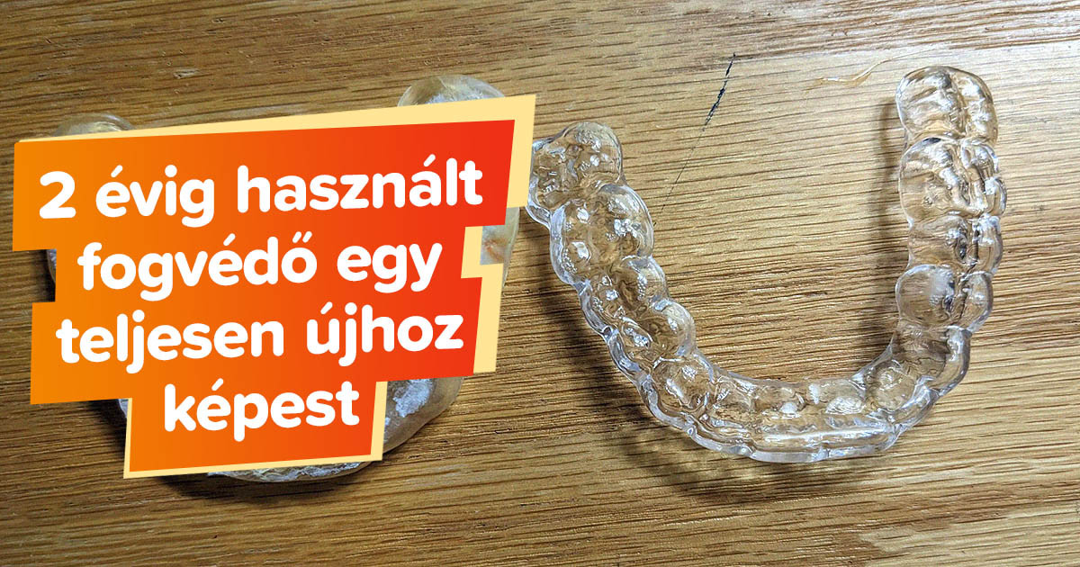 19 ember megmutatta, hogy milyen látványos hatással van az idő a mindennapi dolgainkra