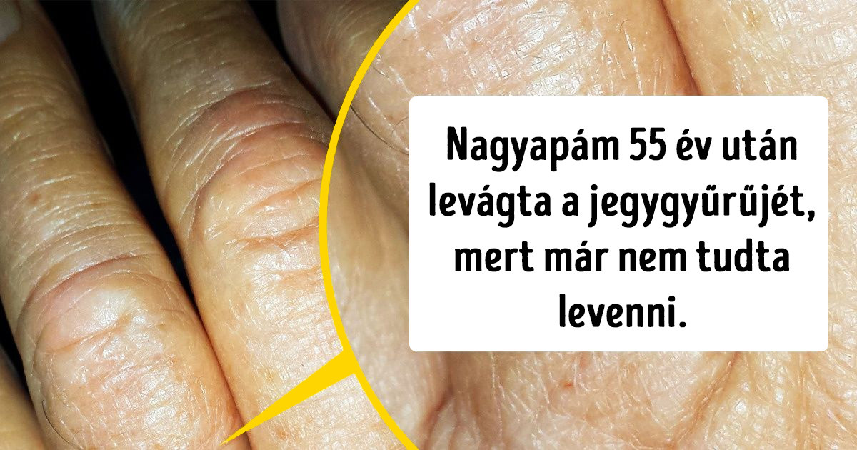 21 fotó, ami megmutatja, milyen látványos változást okoz az idő múlása a mindennapi tárgyainkban