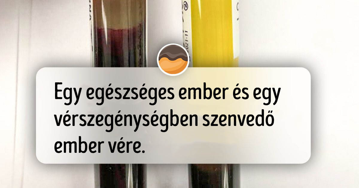 18 összehasonlító fotó, ami pillanatok alatt elmagyarázza, amit általában hosszú ideig kell Gugliznunk