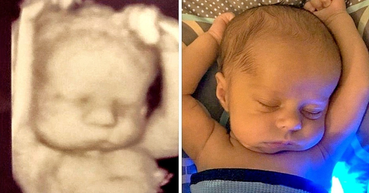 21 előtte-utána fotó, ami minden szónál többet mond