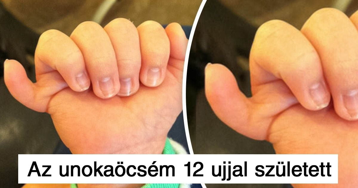 12 ember, akik az egyediségükkel tették még színesebb hellyé a világot