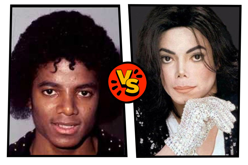 Fekete Michael Jackson vagy fehér Michael Jackson?