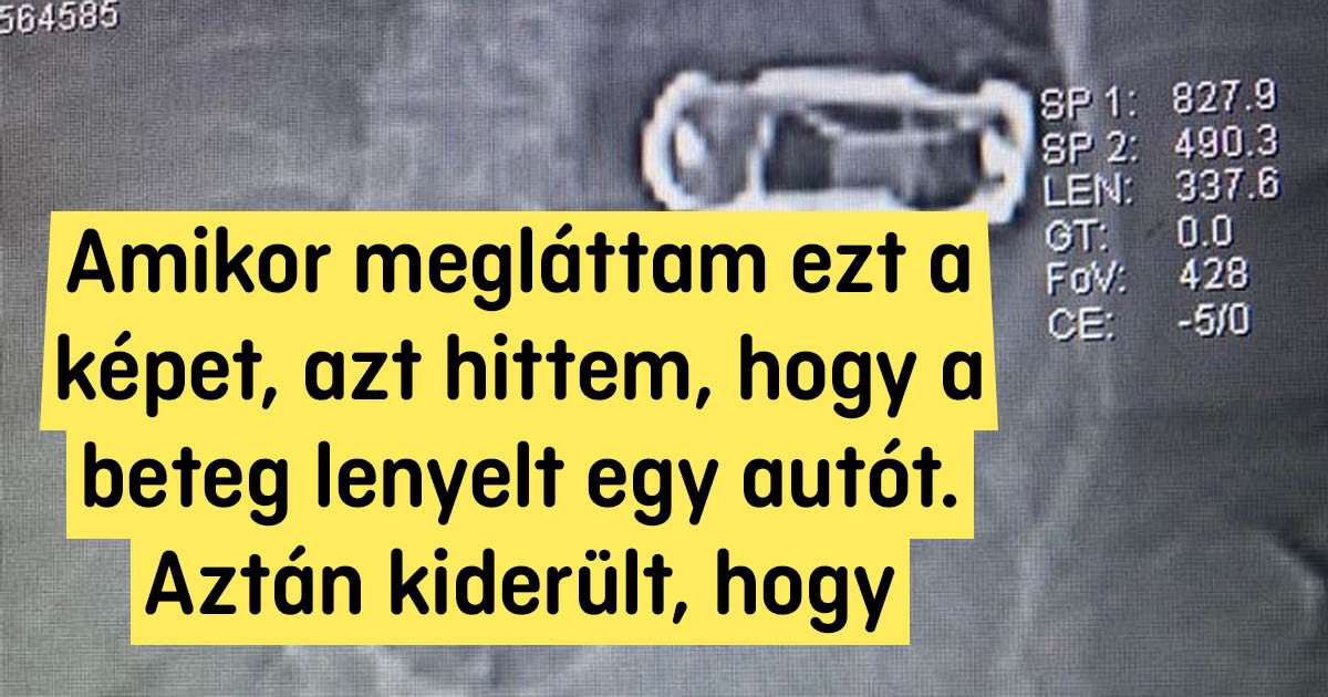15+ bizonyíték rá, hogy a röntgenképek néha egészen lenyűgözőek