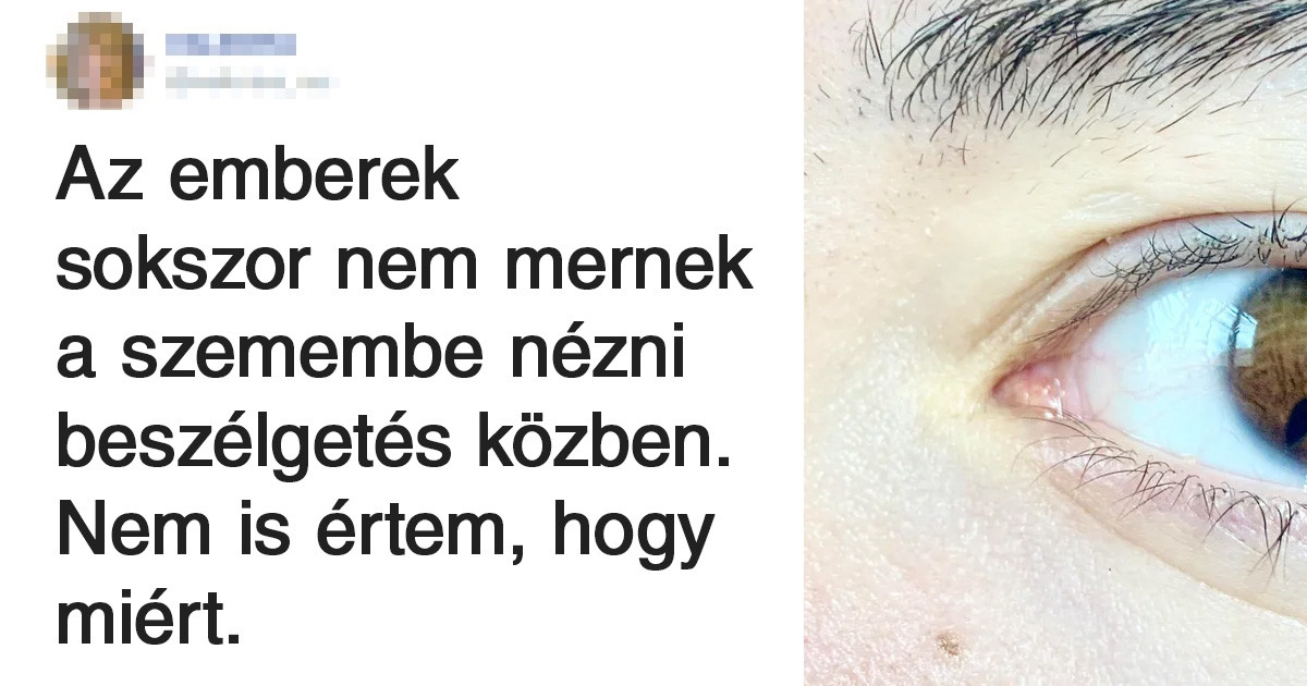 20 különleges megjelenésű ember, akik nem haboztak megmutatni ezt az egész világnak