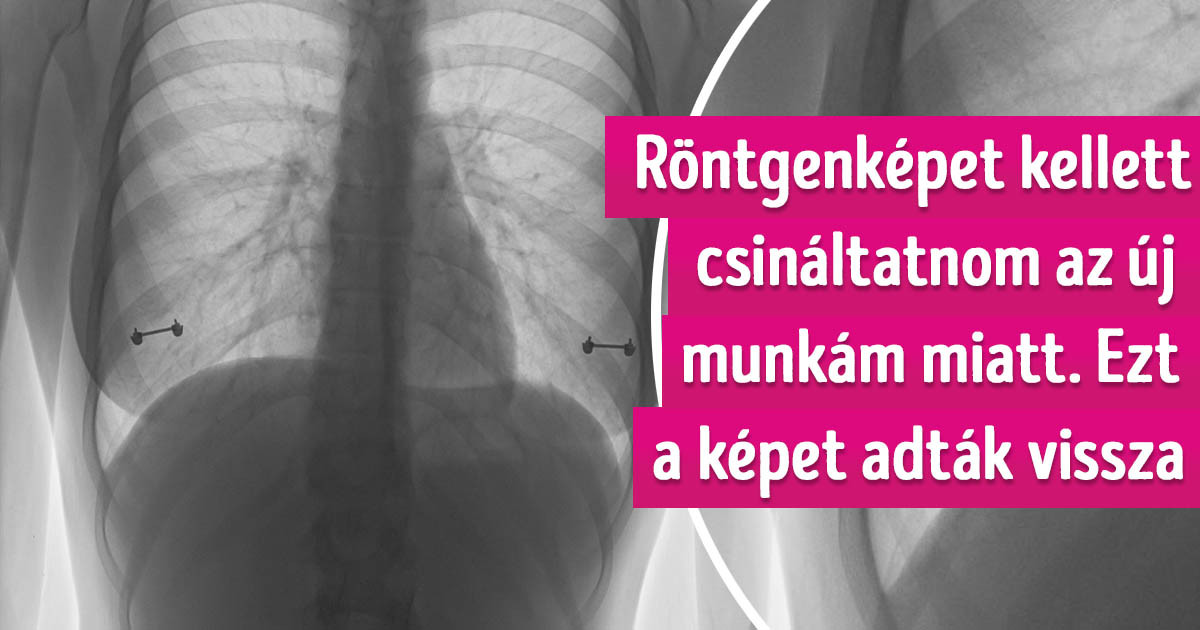 19 dolog, amit a természet nem tud megmutatni nekünk, a röntgen viszont igen