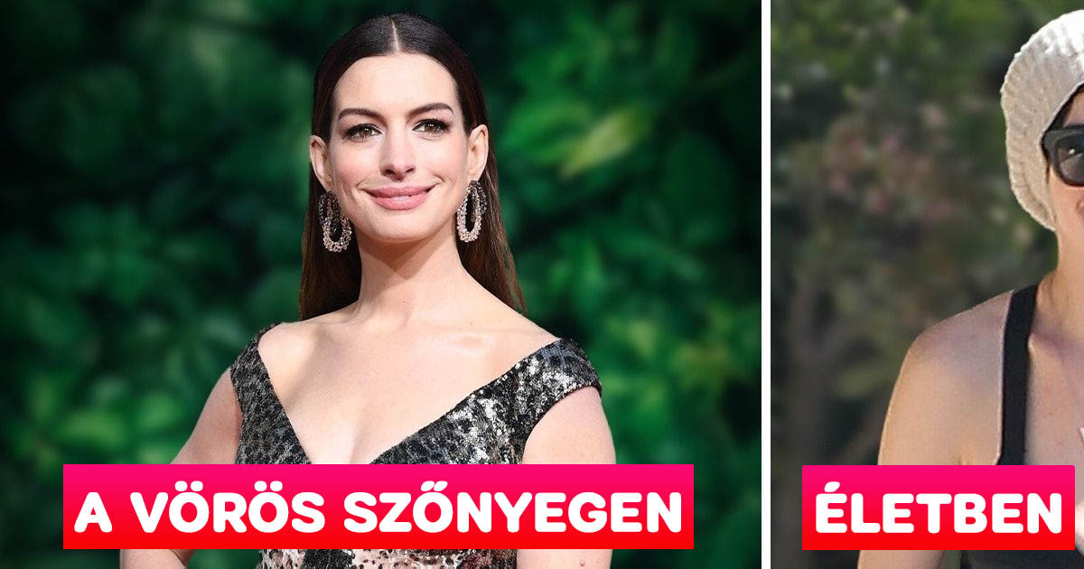 16 sztár, akik ragyognak a vörös szőnyegen, de a való életben pontosan úgy néznek ki, mint te vagy én