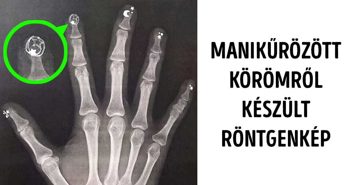 23 fotó, amin az ismerős dolgok rejtélyesebbnek tűnnek, mint a vadidegen tárgyak