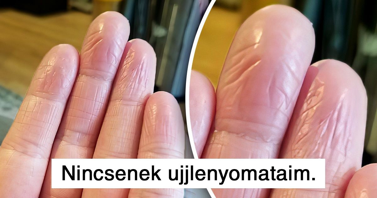 20 ember, aki valami nagyon érdekes dolgot fedezett fel a testén