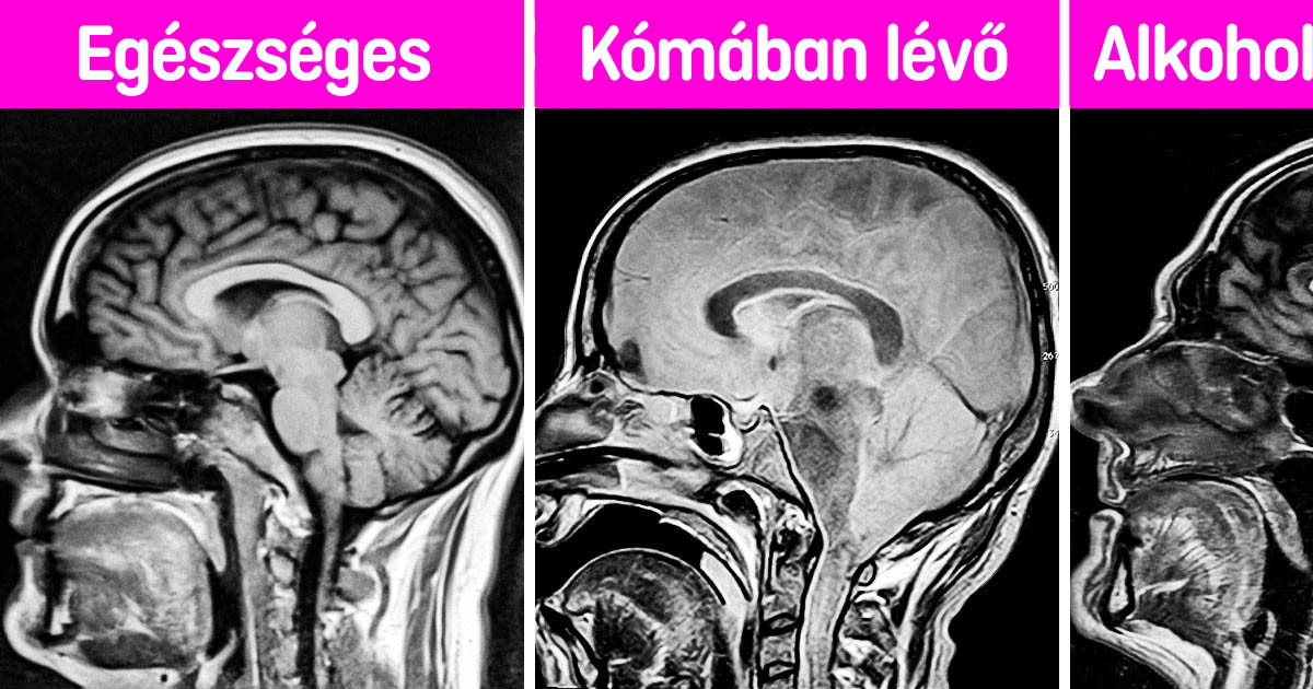 18 röntgenkép, amivel többet lehet tanulni, mint egy anatómiai bemutatón