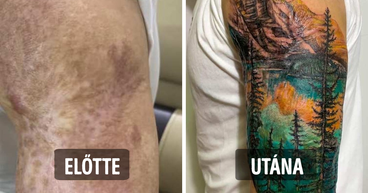 20 tetoválás, ami a hegekből és sérülésekből lenyűgöző műalkotásokat csinált