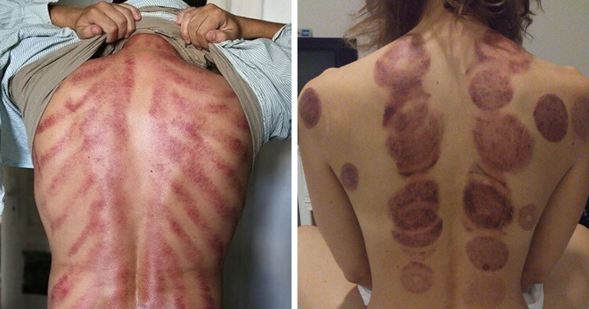 10+ fotó, ami bizonyítja, hogy egy "jó" masszázs eredményét nem csak érezni, de látni is lehet