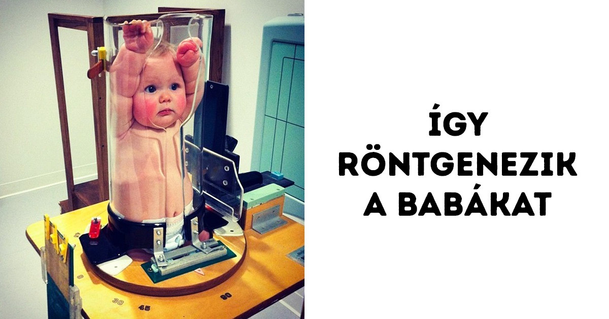20 fotó, ami bizonyítja, hogy az emberi test egy igazi rejtély