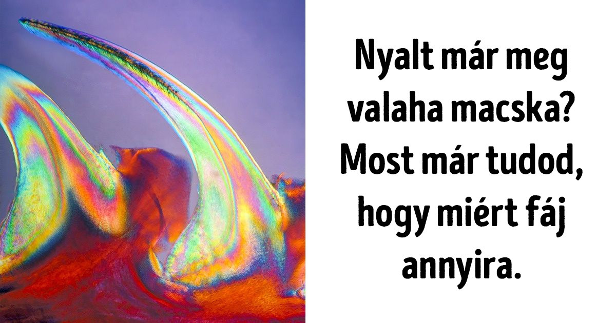 16 mikroszkóp alatt készült fotó, ami úgy mutatja be a körülöttünk lévő világot, ahogy sosem láthattuk még korábban